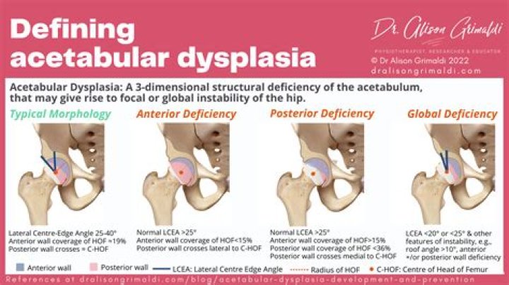 Uncovering The Life And Impact Of Jennifer Brady's Husband