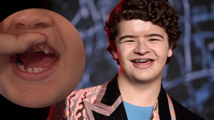 Unveiling Gaten Matarazzo's Rare Disease: Discoveries And Hope
